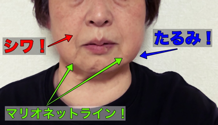 顔の老化